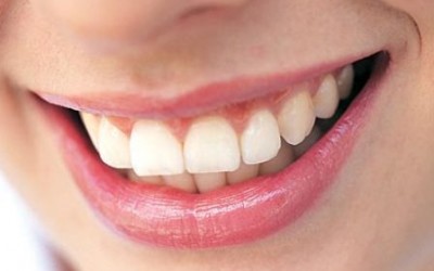 Răng lợi tốt là do vệ sinh tốt?