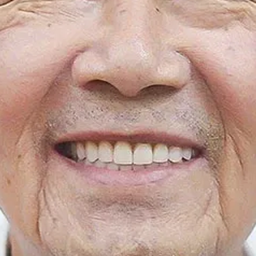 Nhận xét của bác Thanh