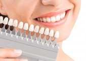 Răng sứ giúp nụ cười tự tin, sức khỏe và sắc đẹp